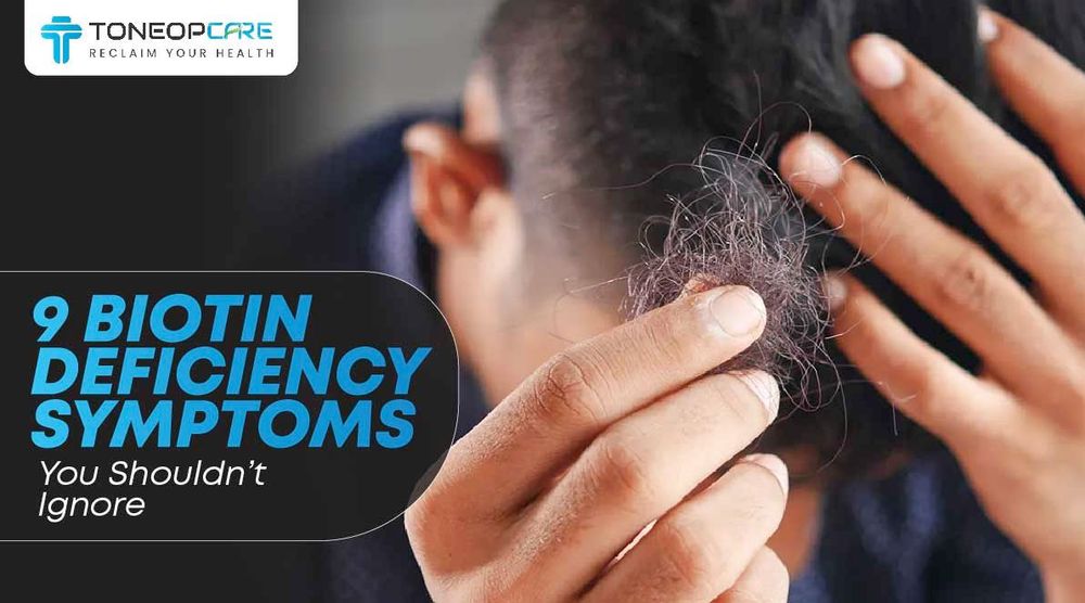 Biotin Deficiency Facies