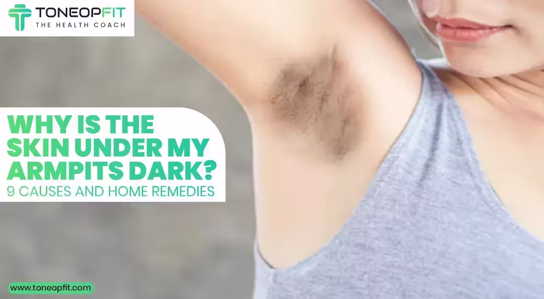 Why Is The Skin Under Your Armpits Dark? 9 Causes, Vitamin Deficiencies, and Home Remedies You Need!